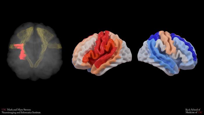 mrtvice a stárnutí mozku