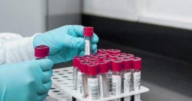 lab, experiment, test, chemistry, test tubes, laboratory, hands, gloves, surgical gloves, blood samples, lab, lab, lab, lab, lab, chemistry, laboratory, laboratory, laboratory, laboratory