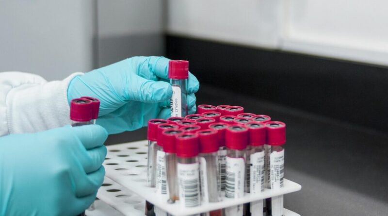 lab, experiment, test, chemistry, test tubes, laboratory, hands, gloves, surgical gloves, blood samples, lab, lab, lab, lab, lab, chemistry, laboratory, laboratory, laboratory, laboratory