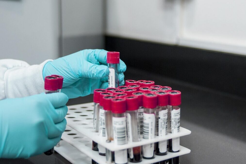 lab, experiment, test, chemistry, test tubes, laboratory, hands, gloves, surgical gloves, blood samples, lab, lab, lab, lab, lab, chemistry, laboratory, laboratory, laboratory, laboratory